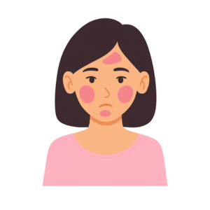 Illustration d’un visage présentant des rougeurs et des imperfections cutanées.