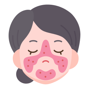 Illustration d'un visage à la peau sensible et rouge avec des rosacées