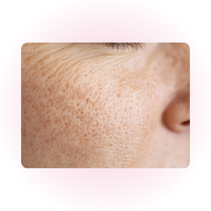 Gros plan sur le grain de peau lissé grâce aux bienfaits de la Centella Asiatica